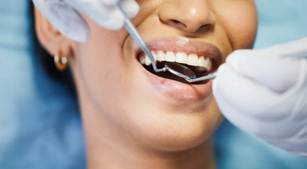 Best Broken Tooth Emergency  in Santa Claus, IN